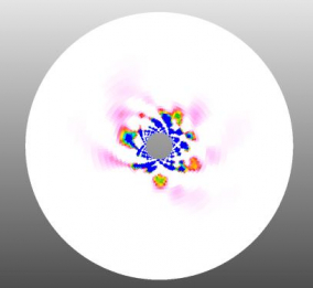 Emergence of localized shear strain around an expanding cavity in the form of logarithmic spirals